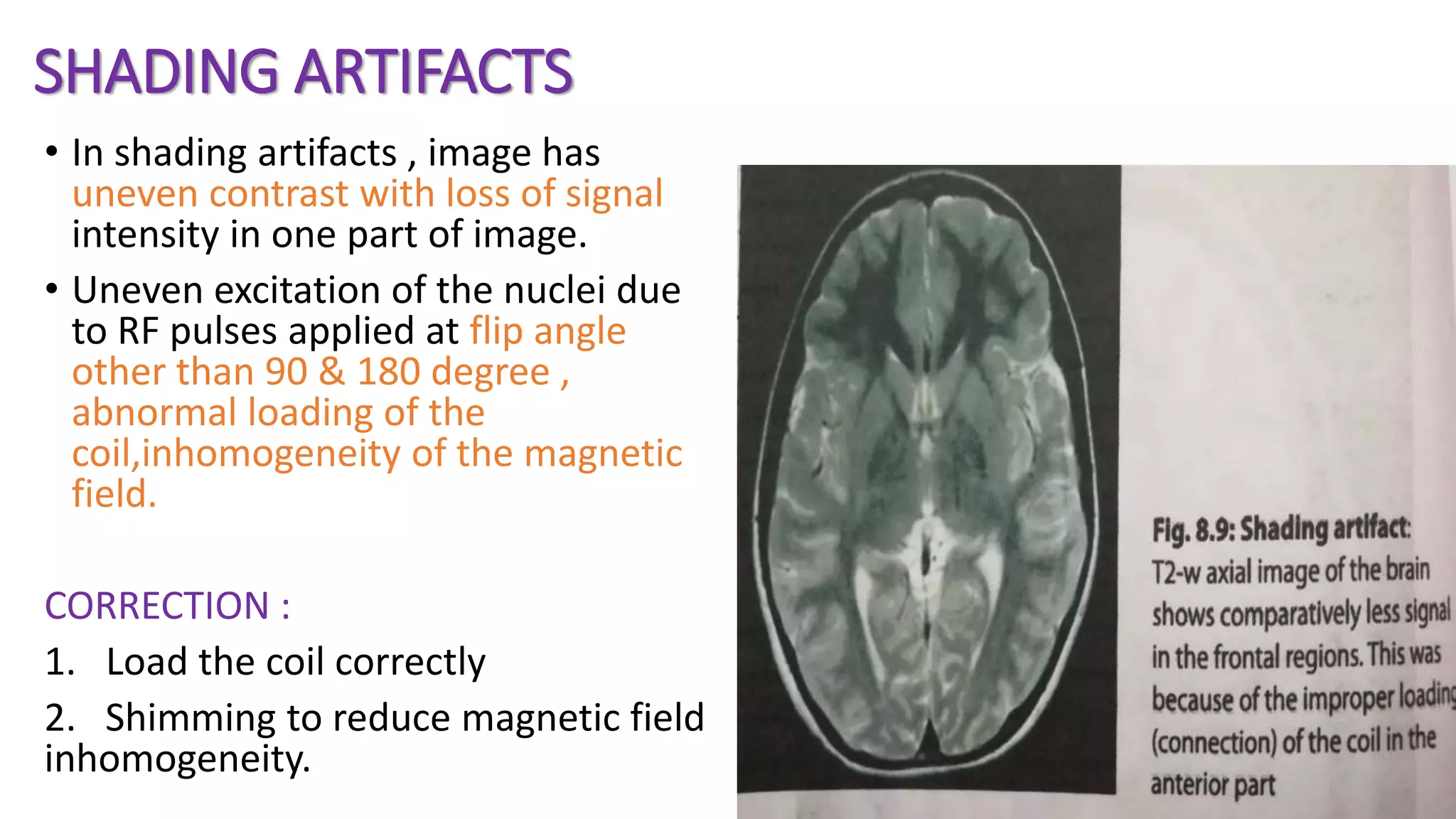 SHADING ARTIFACTS
• In shading artifacts , image has
uneven contrast with loss of signal
intensity in one part of image.
• Uneven excitation of the nuclei due
to RF pulses applied at flip angle
other than 90 & 180 degree ,
abnormal loading of the
coil,inhomogeneity of the magnetic
field.
CORRECTION :
1. Load the coil correctly
2. Shimming to reduce magnetic field
inhomogeneity.
 