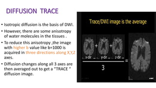 DIFFUSION TRACE
• Isotropic diffusion is the basis of DWI.
• However, there are some anisotropy
of water molecules in the tissues .
• To reduce this anisotropy ,the image
with higher b value like b=1000 is
acquired in three directions along X,Y,Z
axes.
• Diffusion changes along all 3 axes are
then averaged out to get a “TRACE “
diffusion image.
 