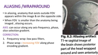 ALIASING /WRAPAROUND
• In aliasing, anatomy that exists outside FOV
appears within the image & on the opposite side.
• When FOV is smaller than the anatomy being
imaged , aliasing occurs.
AXIS :can occur along any axis-frequency ,phase,
slice selection gradient.
CORRECTION:
1. Frequency wrap :low pass filters.
2. Phase wrap : increasing FOV along phase
encoding gradient.
 