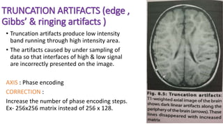 TRUNCATION ARTIFACTS (edge ,
Gibbs’ & ringing artifacts )
• Truncation artifacts produce low intensity
band running through high intensity area.
• The artifacts caused by under sampling of
data so that interfaces of high & low signal
are incorrectly presented on the image.
AXIS : Phase encoding
CORRECTION :
Increase the number of phase encoding steps.
Ex- 256x256 matrix instead of 256 x 128.
 