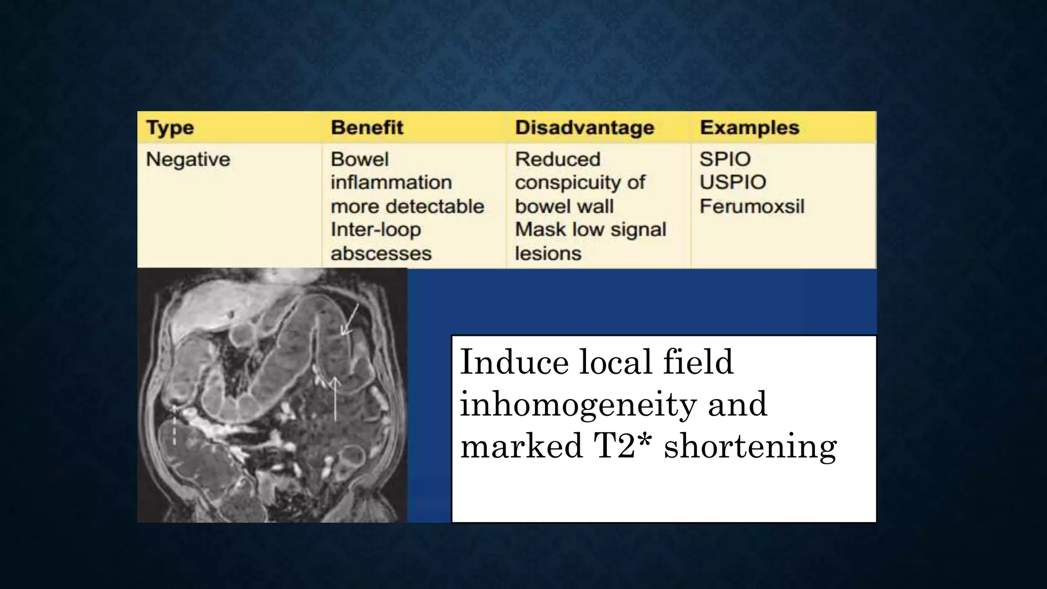Induce local field
inhomogeneity and
marked T2* shortening
 