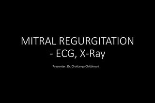 MITRAL REGURGITATION
- ECG, X-Ray
Presenter: Dr. Chaitanya Chittimuri
 