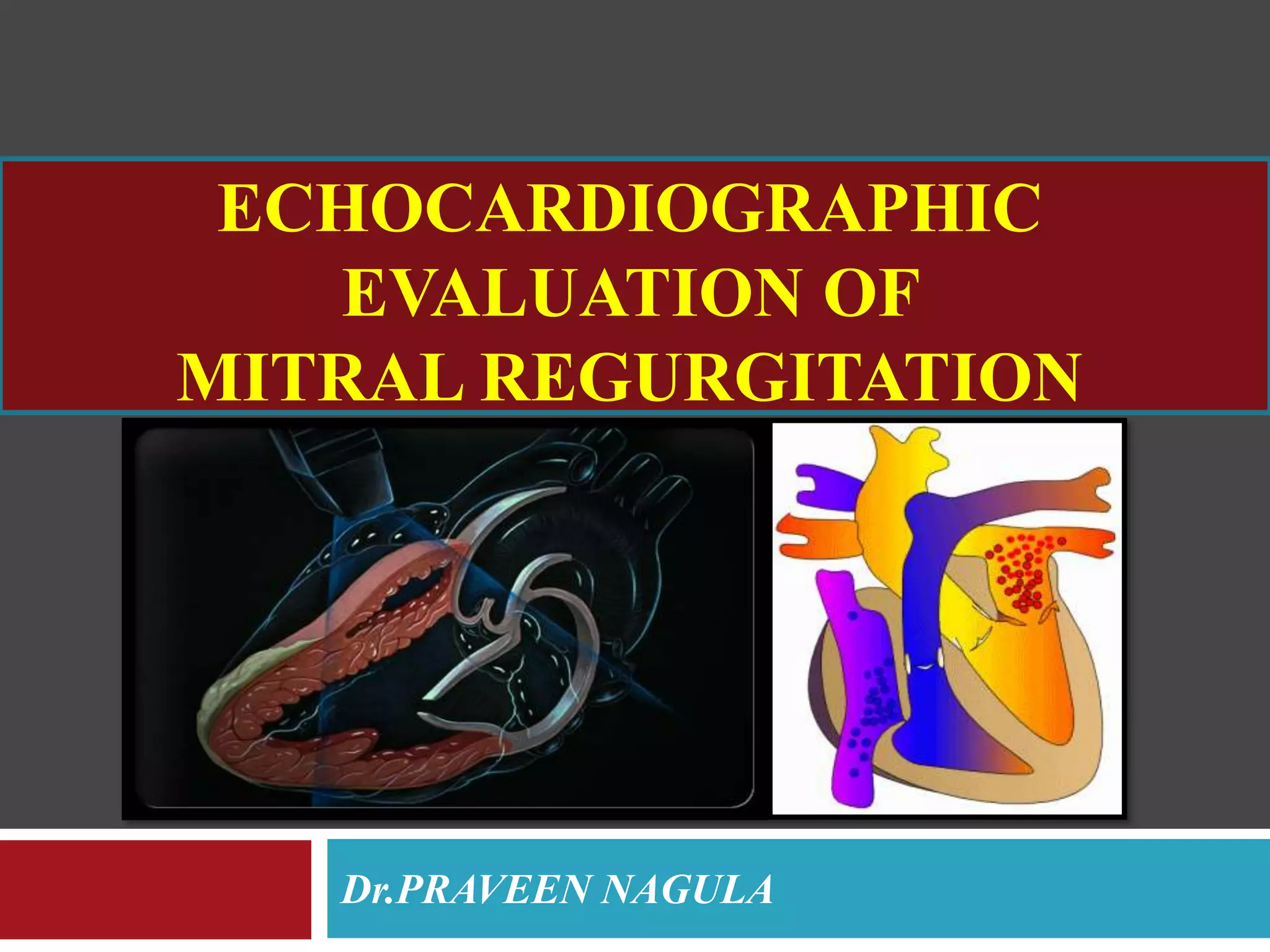 ECHOCARDIOGRAPHIC EVALUATION OF MITRAL VALVE DISEASE -MITRAL ...