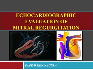 ECHOCARDIOGRAPHIC
EVALUATION OF
MITRAL REGURGITATION
Dr.PRAVEEN NAGULA
 