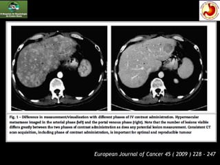 European Journal of Cancer 45 ( 2009 ) 228 - 247
 