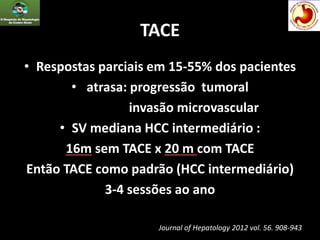 TACE
• Respostas parciais em 15-55% dos pacientes
• atrasa: progressão tumoral
invasão microvascular
• SV mediana HCC intermediário :
16m sem TACE x 20 m com TACE
Então TACE como padrão (HCC intermediário)
3-4 sessões ao ano
Journal of Hepatology 2012 vol. 56. 908-943
 