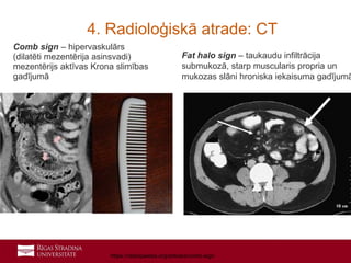 Comb Signct Iekaisīgās zarnu slimības | PPT