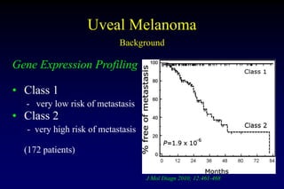Uveal Melanoma
Background
Gene Expression Profiling
• Class 1
- very low risk of metastasis
• Class 2
- very high risk of ...