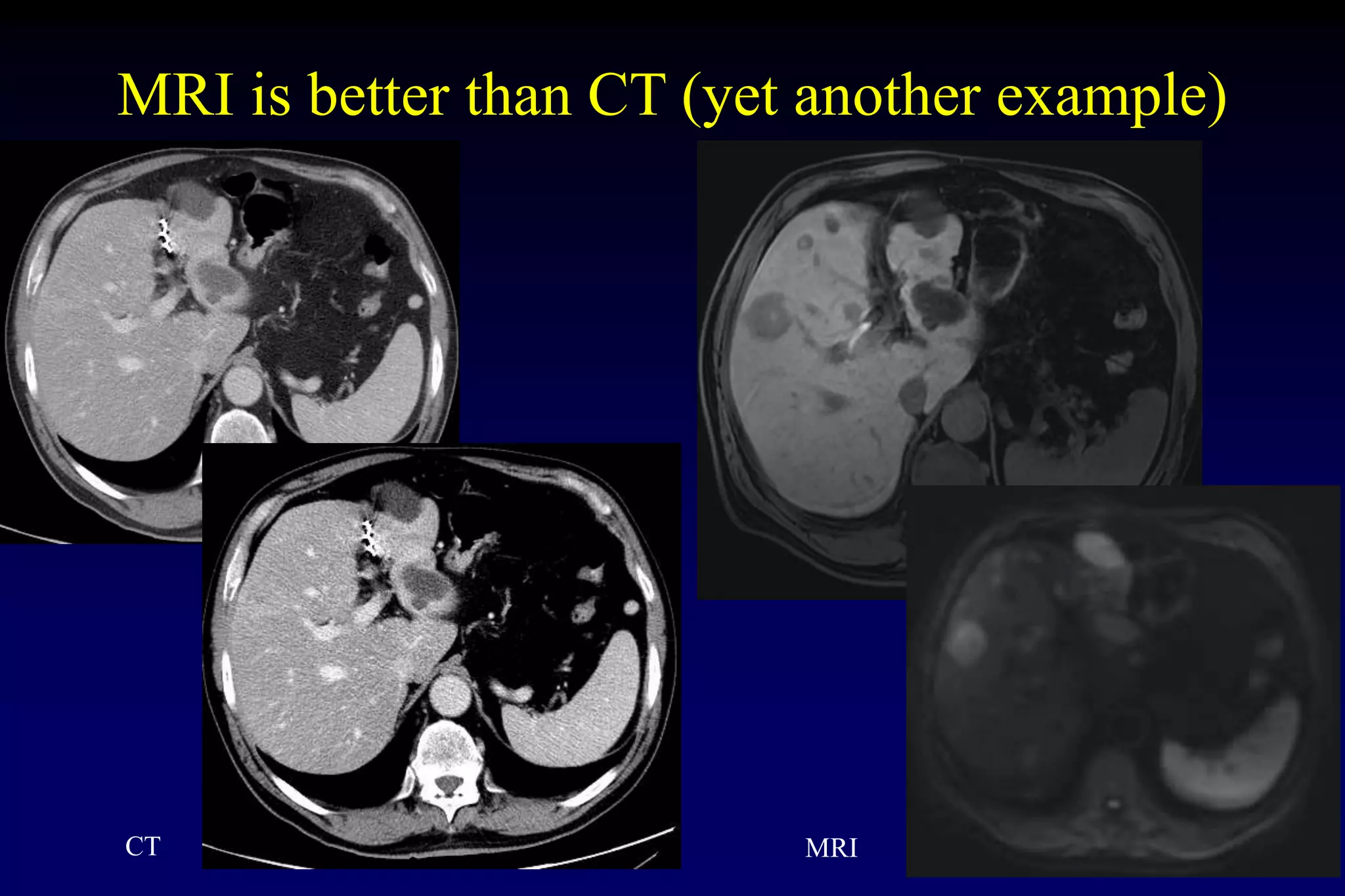 Radiology Basics | PPTX