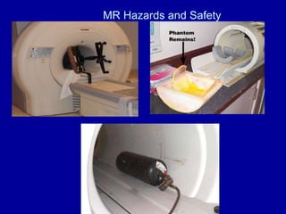 MR Hazards and Safety
 