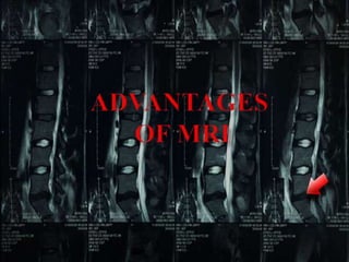 Mri