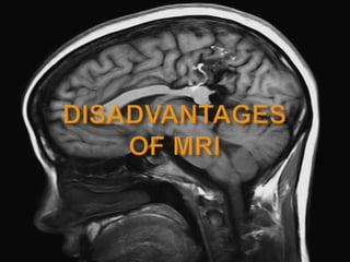 Mri