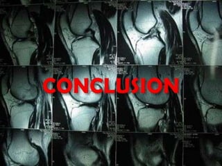 Mri
