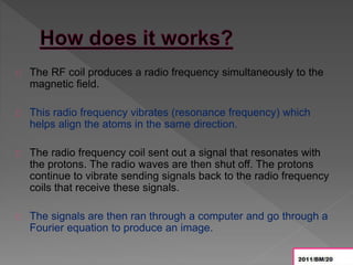 MRI (Magnetic Resonance Imaging) | PPTX | Medical Tests | Medical Health