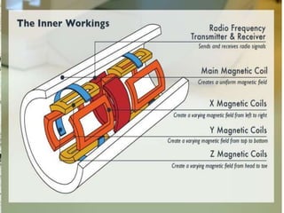 Mri Explain MRI | PPTX