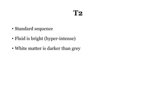 T2
• Standard sequence
• Fluid is bright (hyper-intense)
• White matter is darker than grey
 