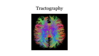 Tractography
 