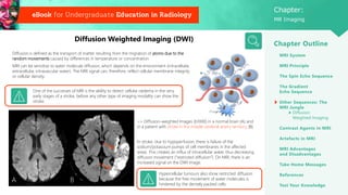 MRI and basic imaging of mri zzzzzxxxxxxxxxx | PDF