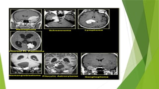 Introduction to MRI for 2nd year radiology students.pptx