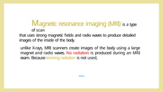 Comprehensive Overview of Magnetic Resonance Imaging (MRI) Principles ...