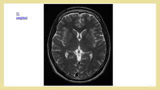 Comprehensive Overview of Magnetic Resonance Imaging (MRI) Principles ...