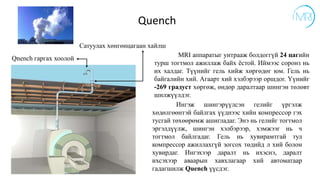 Ингэж шингэрүүлсэн гелийг үргэлж
хөдөлгөөнтэй байлгах үүднээс хийн компрессор гэх
тусгай төхөөрөмж ашигладаг. Энэ нь гелийг тогтмол
эргэлдүүлж, шингэн хэлбэрээр, хэмжээг нь ч
тогтмол байлгадаг. Гель нь хувирамтгай тул
компрессор ажиллахгүй зогсох төдийд л хий болон
хувирдаг. Ингэхээр даралт нь ихэснэ, даралт
ихсэхээр аваарын хавхлагаар хий автоматаар
гадагшилж Quench үүсдэг.
Quench
Qnench гаргах хоолой
Сатуулах хөнгөнцагаан хайлш
MRI аппаратыг унтрааж болдоггүй 24 цагийн
турш тогтмол ажиллаж байх ёстой. Иймээс соронз нь
их халдаг. Түүнийг гель хийж хөргөдөг юм. Гель нь
байгалийн хий. Агаарт хий хэлбэрээр оршдог. Үүнийг
-269 градуст хөргөж, өндөр даралтаар шингэн төлөвт
шилжүүлдэг.
 