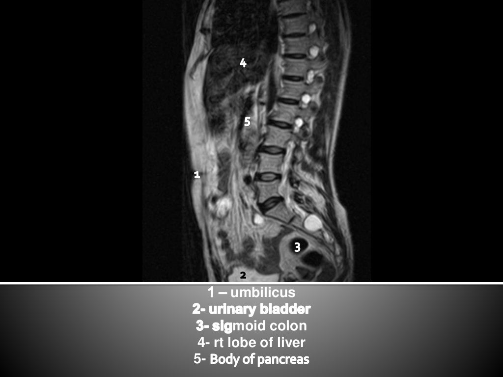 Mri abdomen sagittal
