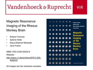 Magnetic Resonance
Imaging of the Rhesus
Monkey Brain
•   Roland Tammer
•   Sabine Hofer
•   Klaus-Dietmar Merboldt
•   Jens Frahm

ISBN: 978-3-525-40424-9
Website:
http://www.v-r.de/en/items/978-3-525-
    40424-9

All images are low resolution samples.
 