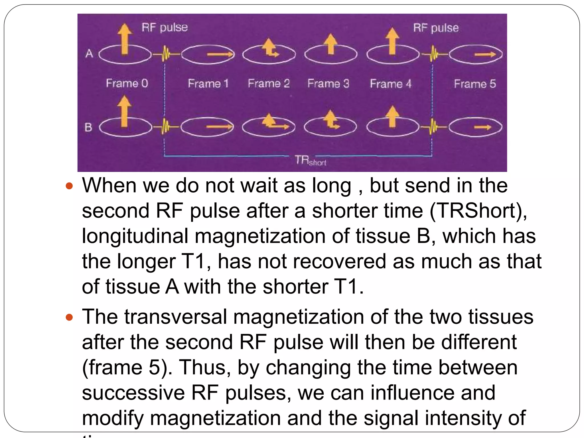  When we do not wait as long , but send in the
second RF pulse after a shorter time (TRShort),
longitudinal magnetization of tissue B, which has
the longer T1, has not recovered as much as that
of tissue A with the shorter T1.
 The transversal magnetization of the two tissues
after the second RF pulse will then be different
(frame 5). Thus, by changing the time between
successive RF pulses, we can influence and
modify magnetization and the signal intensity of
 