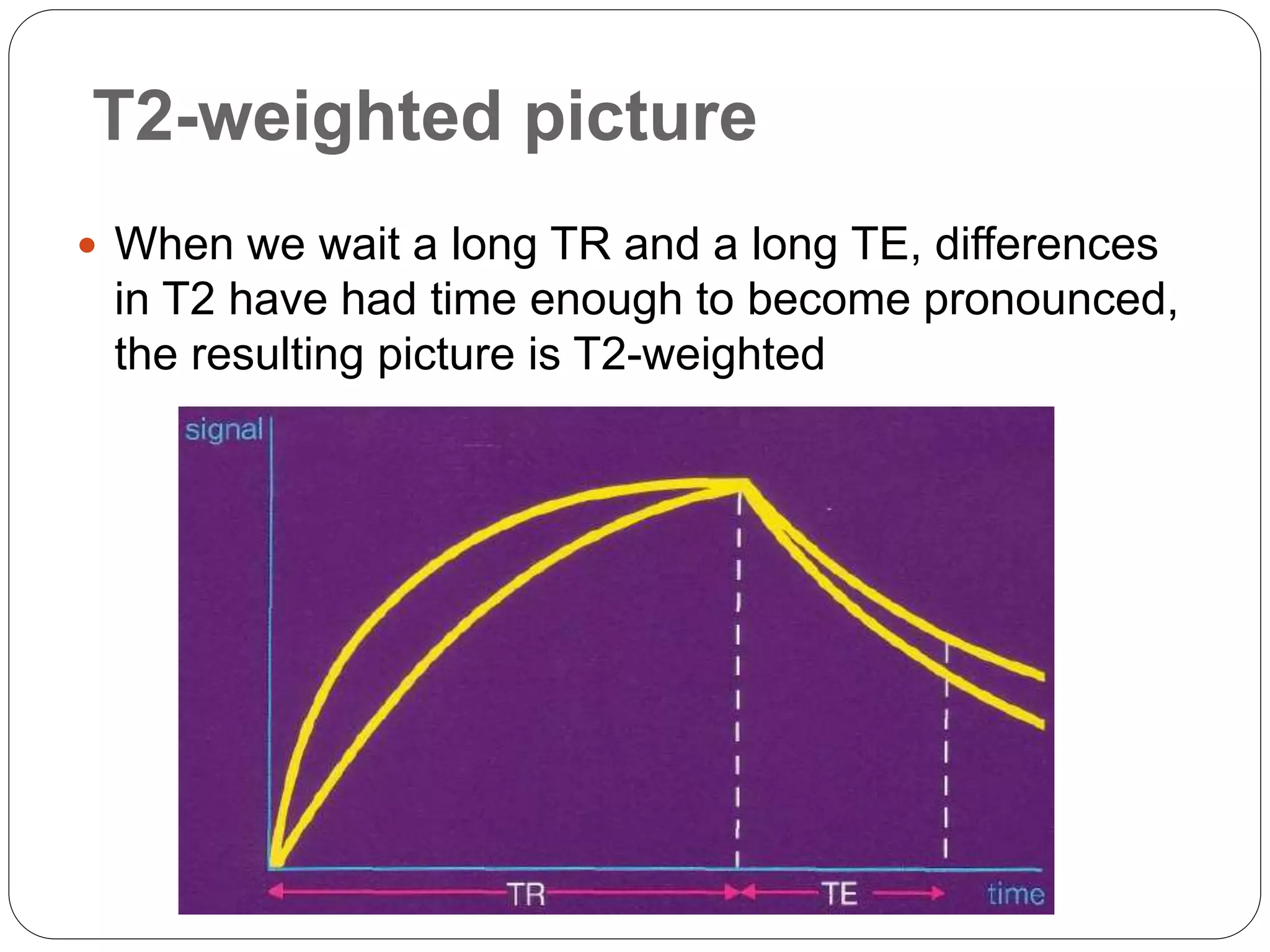 T2-weighted picture
 When we wait a long TR and a long TE, differences
in T2 have had time enough to become pronounced,
the resulting picture is T2-weighted
 