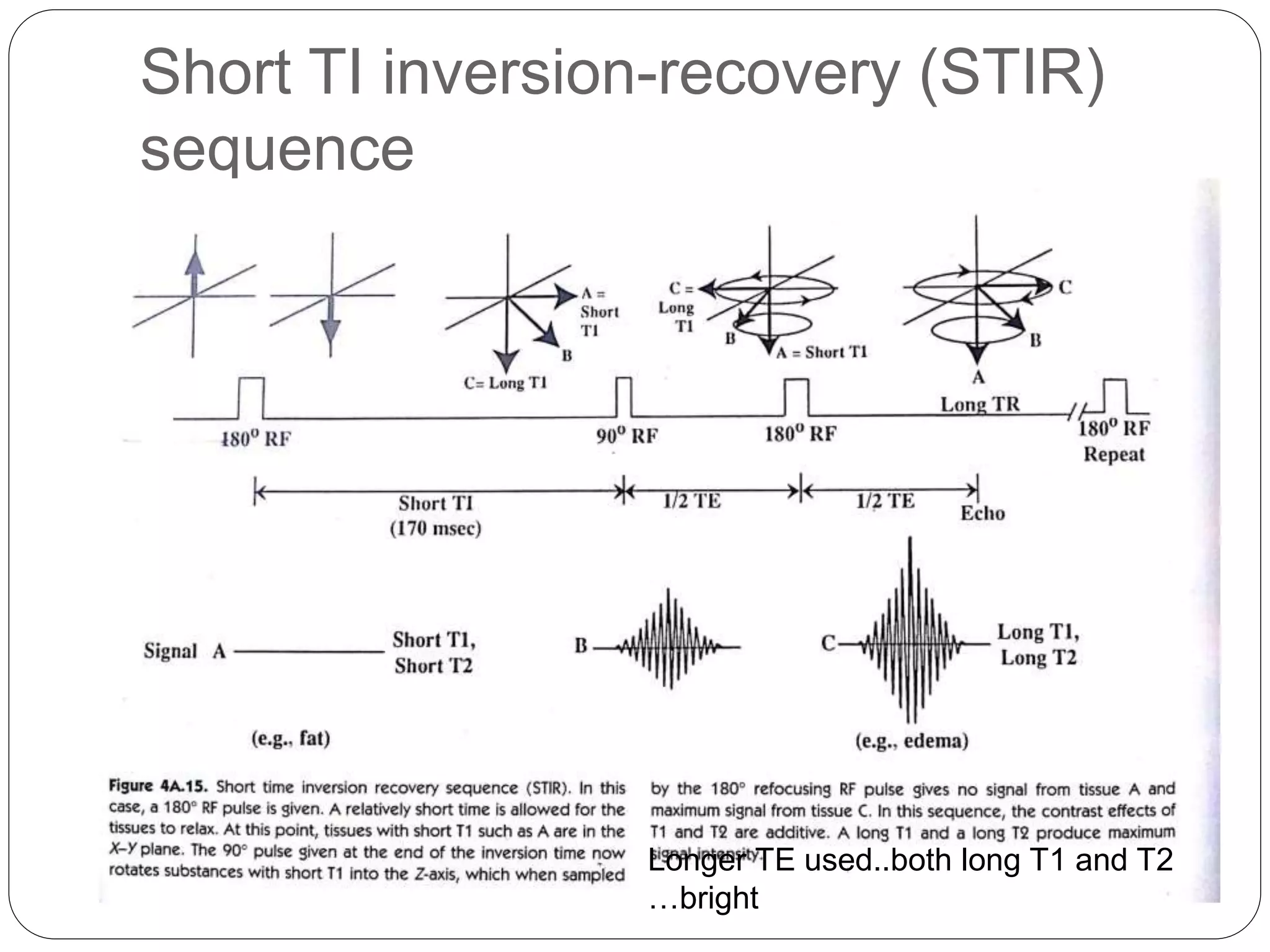 Short TI inversion-recovery (STIR)
sequence
Longer TE used..both long T1 and T2
…bright
 