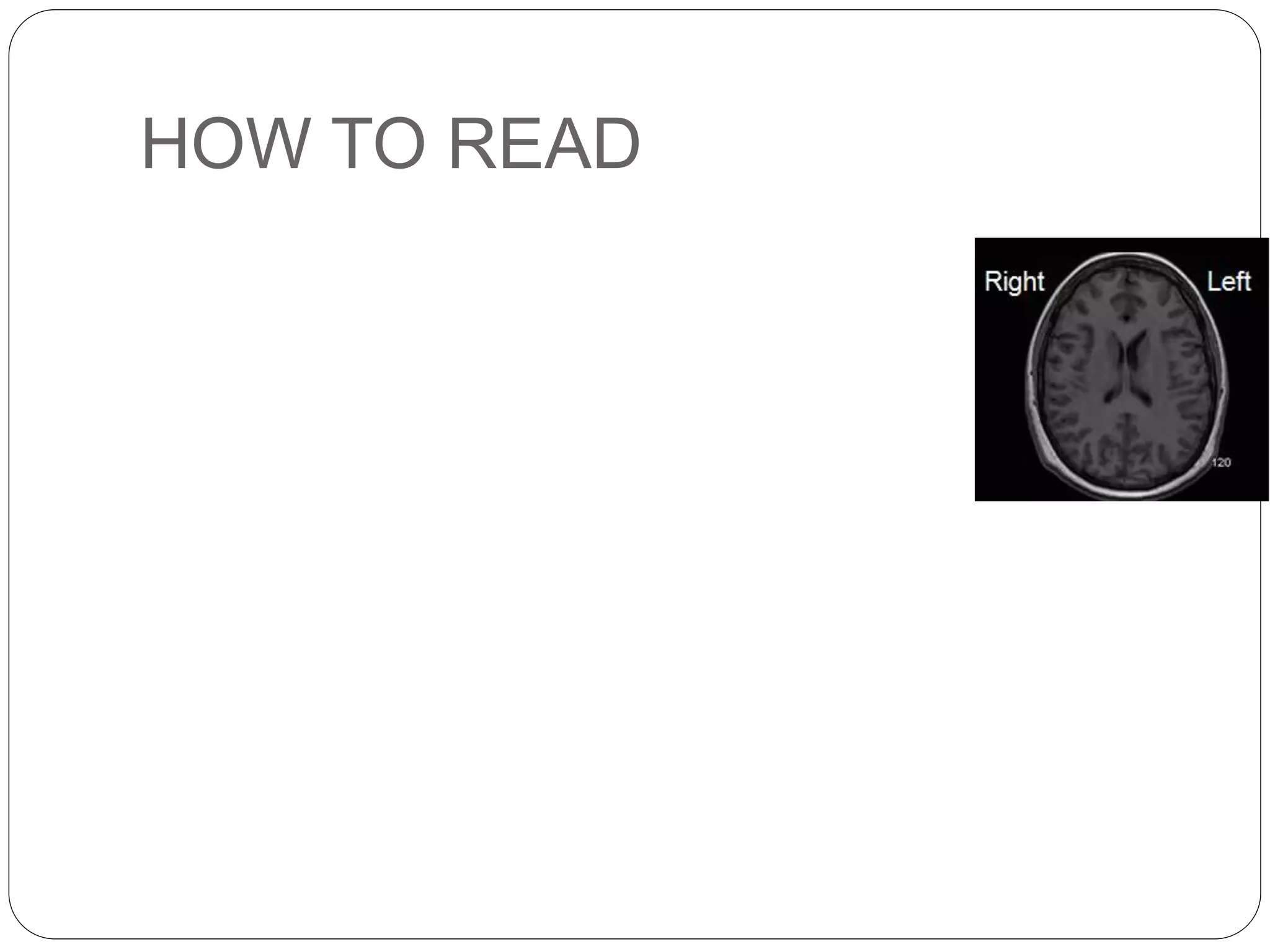 HOW TO READ
 
