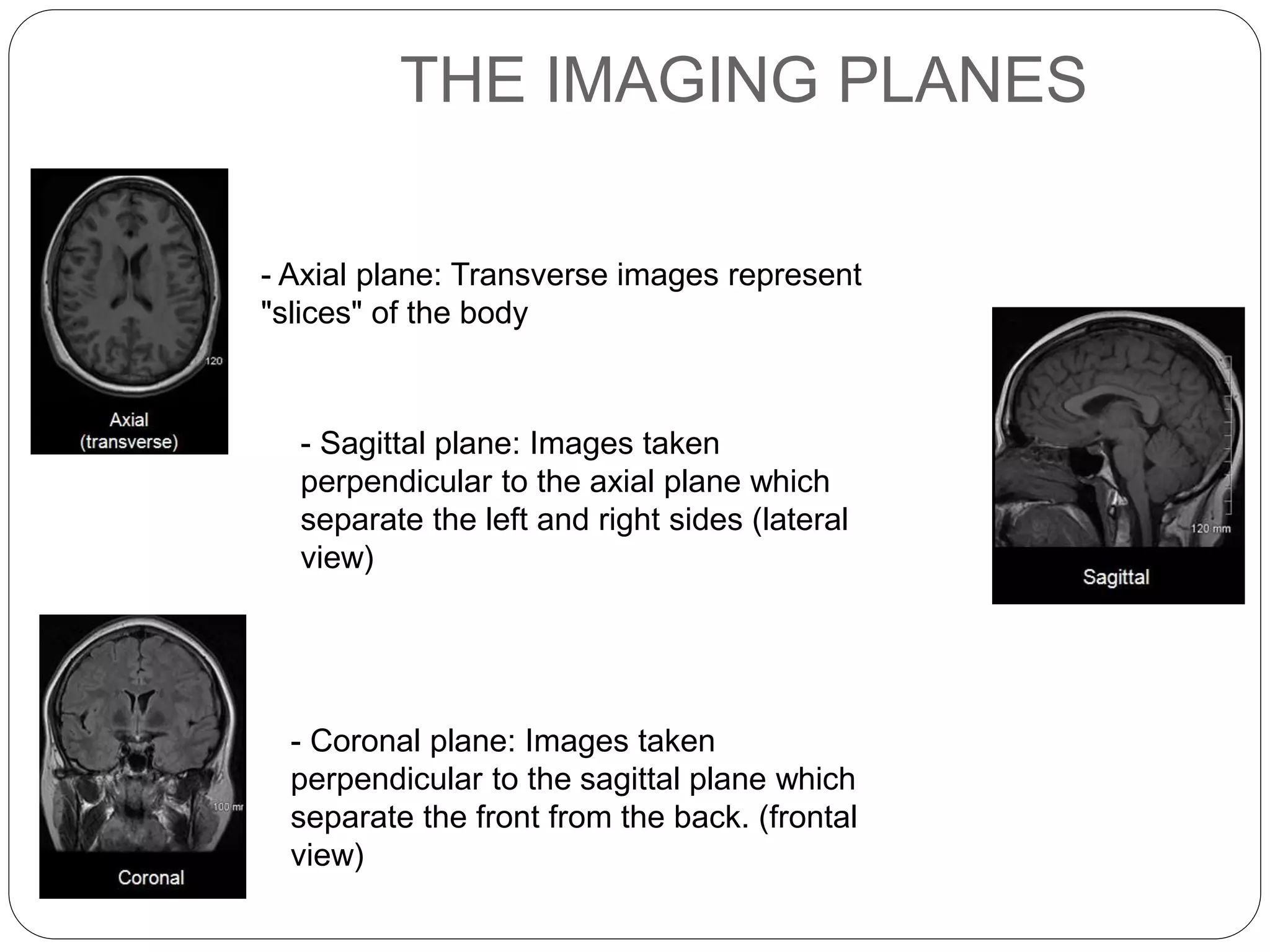THE IMAGING PLANES
- Axial plane: Transverse images represent
"slices" of the body
- Sagittal plane: Images taken
perpendicular to the axial plane which
separate the left and right sides (lateral
view)
- Coronal plane: Images taken
perpendicular to the sagittal plane which
separate the front from the back. (frontal
view)
 