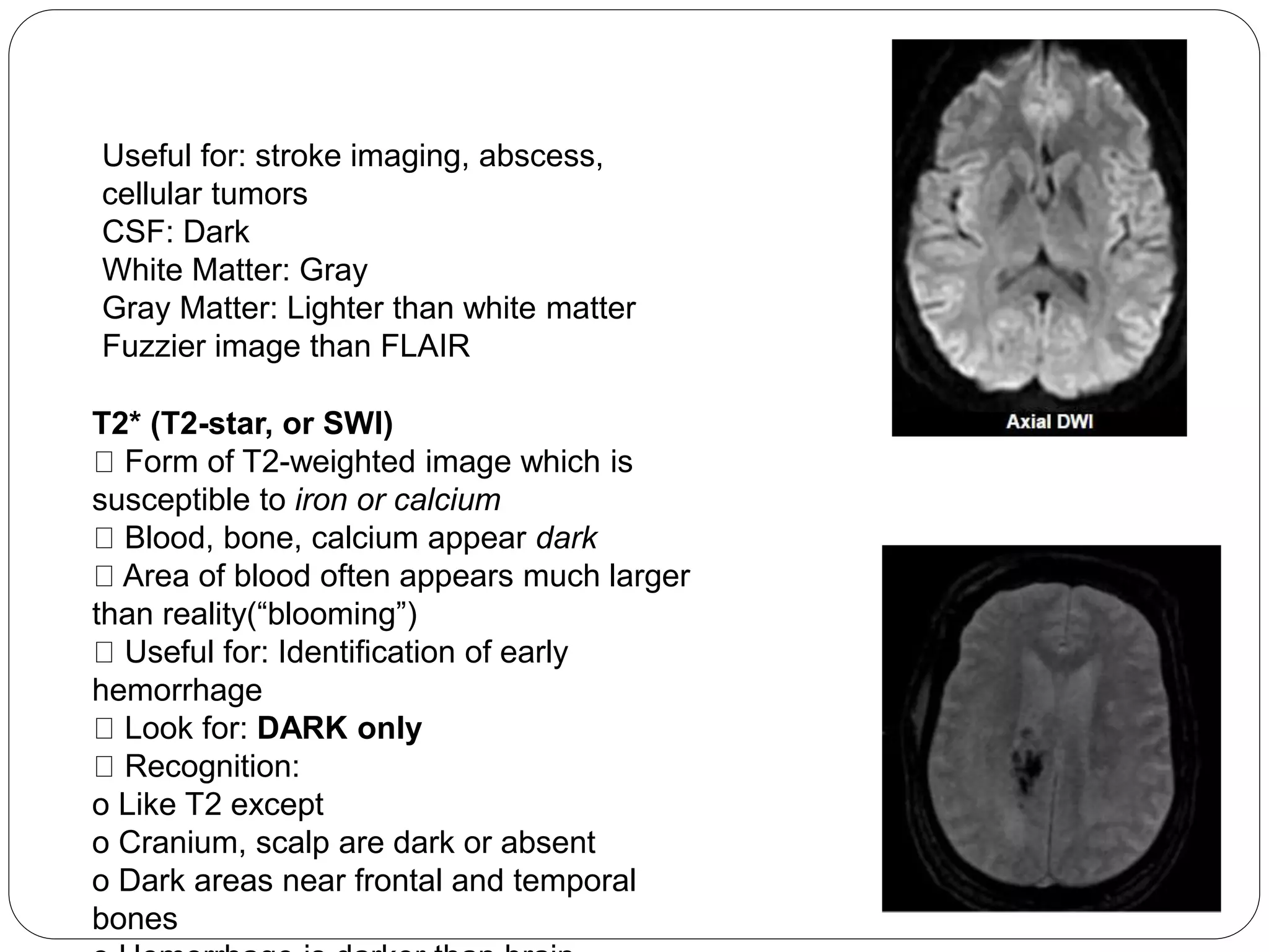 Useful for: stroke imaging, abscess,
cellular tumors
CSF: Dark
White Matter: Gray
Gray Matter: Lighter than white matter
Fuzzier image than FLAIR
T2* (T2-star, or SWI)
Form of T2-weighted image which is
susceptible to iron or calcium
Blood, bone, calcium appear dark
Area of blood often appears much larger
than reality(“blooming”)
Useful for: Identification of early
hemorrhage
Look for: DARK only
Recognition:
o Like T2 except
o Cranium, scalp are dark or absent
o Dark areas near frontal and temporal
bones
 