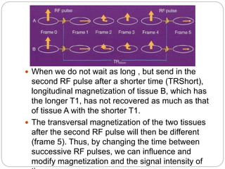  When we do not wait as long , but send in the
second RF pulse after a shorter time (TRShort),
longitudinal magnetization of tissue B, which has
the longer T1, has not recovered as much as that
of tissue A with the shorter T1.
 The transversal magnetization of the two tissues
after the second RF pulse will then be different
(frame 5). Thus, by changing the time between
successive RF pulses, we can influence and
modify magnetization and the signal intensity of
 