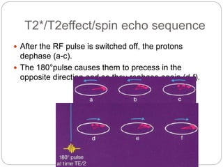 T2*/T2effect/spin echo sequence
 After the RF pulse is switched off, the protons
dephase (a-c).
 The 180°pulse causes them to precess in the
opposite direction and so they rephase again (d-f).
 