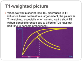 T1-weighted picture
 When we wait a shorter time TR, differences in T1
influence tissue contrast to a larger extent, the picture is
T1-weighted, especially when we also wait a short TE
(when signal differences due to differing T2s have not
had time to become pronounced)
 