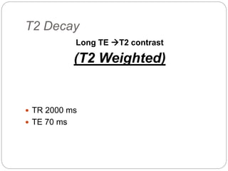 T2 Decay
Long TE T2 contrast
(T2 Weighted)
 TR 2000 ms
 TE 70 ms
 