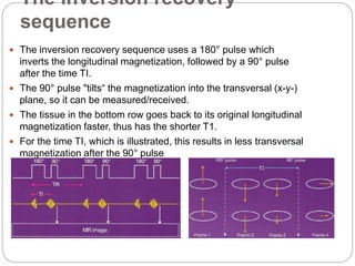The inversion recovery
sequence
 The inversion recovery sequence uses a 180° pulse which
inverts the longitudinal magnetization, followed by a 90° pulse
after the time TI.
 The 90° pulse "tilts“ the magnetization into the transversal (x-y-)
plane, so it can be measured/received.
 The tissue in the bottom row goes back to its original longitudinal
magnetization faster, thus has the shorter T1.
 For the time TI, which is illustrated, this results in less transversal
magnetization after the 90° pulse
 