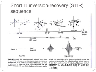 Short TI inversion-recovery (STIR)
sequence
Longer TE used..both long T1 and T2
…bright
 