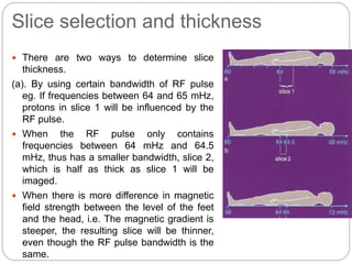 Slice selection and thickness
 There are two ways to determine slice
thickness.
(a). By using certain bandwidth of RF pulse
eg. If frequencies between 64 and 65 mHz,
protons in slice 1 will be influenced by the
RF pulse.
 When the RF pulse only contains
frequencies between 64 mHz and 64.5
mHz, thus has a smaller bandwidth, slice 2,
which is half as thick as slice 1 will be
imaged.
 When there is more difference in magnetic
field strength between the level of the feet
and the head, i.e. The magnetic gradient is
steeper, the resulting slice will be thinner,
even though the RF pulse bandwidth is the
same.
 