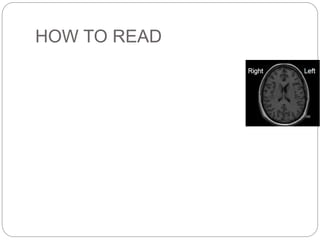 HOW TO READ
 