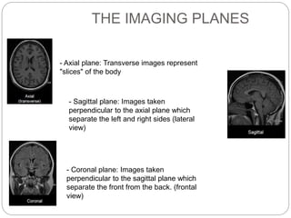 THE IMAGING PLANES
- Axial plane: Transverse images represent
"slices" of the body
- Sagittal plane: Images taken
perpendicular to the axial plane which
separate the left and right sides (lateral
view)
- Coronal plane: Images taken
perpendicular to the sagittal plane which
separate the front from the back. (frontal
view)
 
