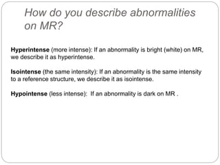 How do you describe abnormalities
on MR?
Hyperintense (more intense): If an abnormality is bright (white) on MR,
we describe it as hyperintense.
Isointense (the same intensity): If an abnormality is the same intensity
to a reference structure, we describe it as isointense.
Hypointense (less intense): If an abnormality is dark on MR .
 
