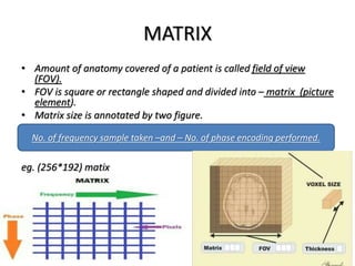 MATRIX
• Amount of anatomy covered of a patient is called field of view
(FOV).
• FOV is square or rectangle shaped and divided into – matrix (picture
element).
• Matrix size is annotated by two figure.
eg. (256*192) matix
No. of frequency sample taken –and – No. of phase encoding performed.
 