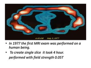 • In 1977 the first MRI exam was performed on a
human being.
• To create single slice it took 4 hour.
performed with field strength 0.05T
 