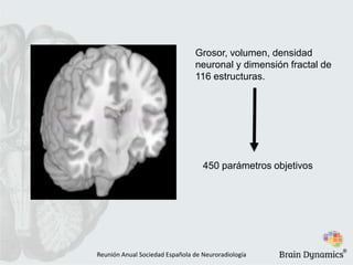 Grosor, volumen, densidad
neuronal y dimensión fractal de
116 estructuras.
450 parámetros objetivos
Reunión Anual Sociedad Española de Neuroradiología
®