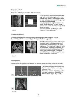 Mri physics-uk | PDF