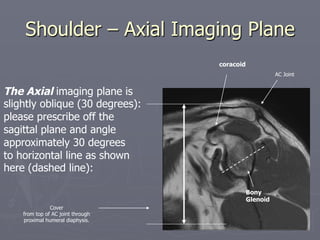 Shoulder – Axial Imaging Plane
The Axial imaging plane is
slightly oblique (30 degrees):
please prescribe off the
sagittal plane and angle
approximately 30 degrees
to horizontal line as shown
here (dashed line):
Bony
Glenoid
coracoid
AC Joint
Cover
from top of AC joint through
proximal humeral diaphysis.
 