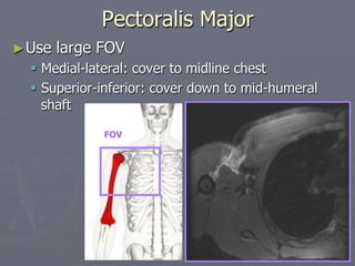 Pectoralis Major
►Use large FOV
§ Medial-lateral: cover to midline chest
§ Superior-inferior: cover down to mid-humeral
shaft
FOV
 